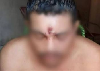 Homem é baleado na testa, volta para a casa e dorme como se nada tivesse acontecido