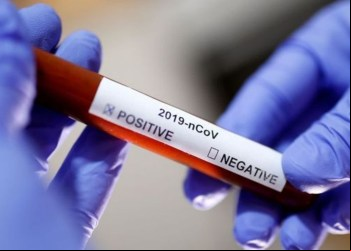 Covid-19: Brasil registra 74,5 mil casos e 396 mortes em 24 horas