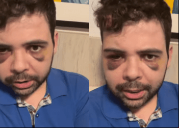 POLÍCIA CIVIL DESMENTE VERSÃO DE GUSTAVO MENDES; HUMORISTA REBATE